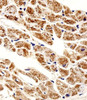 Immunohistochemical analysis of paraffin-embedded H.heart section using ZNF175 Antibody (N-term) . Antibody was diluted at 1:25 dilution. A peroxidase-conjugated goat anti-rabbit IgG at 1:400 dilution was used as the secondary antibody, followed by DAB staining.