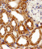 Immunohistochemical analysis of paraffin-embedded H. kidney section using FBXL17 Isoform 2 Antibody . Antibody was diluted at 1:100 dilution. A peroxidase-conjugated goat anti-rabbit IgG at 1:400 dilution was used as the secondary antibody, followed by DAB staining.