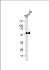 Western blot analysis of lysate from Daudi cell line, using CHRNA9 Antibody at 1:1000.