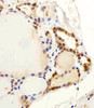 Immunohistochemical analysis of paraffin-embedded H.thyroid section using C13orf30 Antibody . Antibody was diluted at 1:25 dilution. A peroxidase-conjugated goat anti-rabbit IgG at 1:400 dilution was used as the secondary antibody, followed by DAB staining.