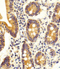 Immunohistochemical analysis of paraffin-embedded H. duodenum section using STRADA Antibody . Antibody was diluted at 1:100 dilution. A peroxidase-conjugated goat anti-rabbit IgG at 1:400 dilution was used as the secondary antibody, followed by DAB staining.