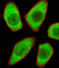 Fluorescent image of A549 cells stained with STRADA Antibody . AP20607C was diluted at 1:25 dilution. An Alexa Fluor 488-conjugated goat anti-rabbit lgG at 1:400 dilution was used as the secondary antibody (green) . Cytoplasmic actin was counterstained with Alexa Fluor 555 conjugated with Phalloidin (red) .