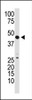 Antibody is used in Western blot to detect GDF3 in mouse kidney tissue lysate.