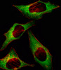 Fluorescent image of Hela cell stained with HIP2 Antibody .Hela cells were fixed with 4% PFA (20 min) , permeabilized with Triton X-100 (0.1%, 10 min) , then incubated with HIP2 primary antibody (1:25) . For secondary antibody, Alexa Fluor 488 conjugated donkey anti-rabbit antibody (green) was used (1:400) .Cytoplasmic actin was counterstained with Alexa Fluor 555 (red) conjugated Phalloidin (7units/ml) . HIP2 immunoreactivity is localized to Cytoplasm significantly.