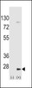 Western blot analysis of UBE2H using rabbit polyclonal UBE2H Antibody (S167) using 293 cell lysates (2 ug/lane) either nontransfected (Lane 1) or transiently transfected (Lane 2) with the UBE2H gene.