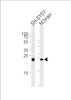 Western blot analysis of lysates from SH-SY5Y cell line and mouse brain tissue (from left to right) , using UCHL1 Antibody .AP2126e was diluted at 1:1000 at each lane.