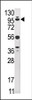 Western blot analysis of anti-USP1 Pab in HepG2 cell line lysate (35ug/lane) .