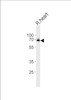 Western blot analysis of lysate from R. heart cell line, using USP2 Antibody (T22) at 1:1000.