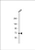 Western Blot at 1:2000 dilution + Hela whole cell lysate Lysates/proteins at 20 ug per lane.