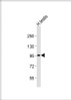 Western Blot at 1:2000 dilution + human testis lysates Lysates/proteins at 20 ug per lane.