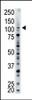 Antibody is used in Western blot to detect USP15 in mouse brain tissue lysate.