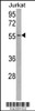 Western blot analysis of USP22 Antibody in Jurkat cell line lysates (35ug/lane)