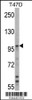 Western blot analysis of UBE3A Antibody in T47D cell line lysates (35ug/lane) .