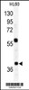 Western blot analysis of RAD23A Antibody in HL60 cell line lysates (35ug/lane)