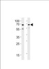 Western blot analysis in SH-SY5Y, U87-MG cell line lysates (35ug/lane) .This demonstrates the PLIC1 antibody detected the PLIC1 protein (arrow) .