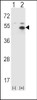 Western blot analysis of STAM using rabbit polyclonal STAM Antibody (P341) using 293 cell lysates (2 ug/lane) either nontransfected (Lane 1) or transiently transfected (Lane 2) with the STAM gene.