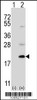 Western blot analysis of Ufc1 using rabbit polyclonal Ufc1 Antibody using 293 cell lysates (2 ug/lane) either nontransfected (Lane 1) or transiently transfected (Lane 2) with the Ufc1 gene.