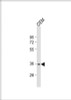 Western Blot at 1:2000 dilution + CEM whole cell lysate Lysates/proteins at 20 ug per lane.