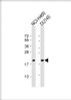 Western Blot at 1:8000 dilution Lane 1: NCI-H460 whole cell lysate Lane 2: DU145 whole cell lysate Lysates/proteins at 20 ug per lane.