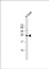 Western Blot at 1:2000 dilution + human liver lysate Lysates/proteins at 20 ug per lane.