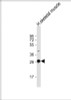 Western Blot at 1:2000 dilution + human skeletal muscle lysate Lysates/proteins at 20 ug per lane.