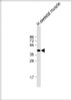 Western Blot at 1:2000 dilution + human skeletal muscle lysate Lysates/proteins at 20 ug per lane.