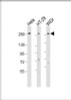 Western Blot at 1:1000-1:2000 dilution Lane 1: Hela whole cell lysate Lane 2: HT-29 whole cell lysate Lane 3: WiDr whole cell lysate Lysates/proteins at 20 ug per lane.