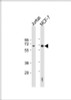 Western Blot at 1:2000 dilution Lane 1: Jurkat whole cell lysate Lane 2: MCF-7 whole cell lysate Lysates/proteins at 20 ug per lane.