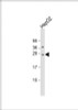 Western Blot at 1:2000 dilution + HepG2 whole cell lysate Lysates/proteins at 20 ug per lane.