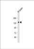 Western Blot at 1:2000 dilution + mouse brain lysate Lysates/proteins at 20 ug per lane.