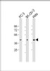 Western Blot at 1:1000-1:2000 dilution Lane 1: PC-3 whole cell lysate Lane 2: SK-OV-3 whole cell lysate Lane 3: Hela whole cell lysate Lysates/proteins at 20 ug per lane.