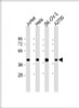 Western Blot at 1:2000 dilution Lane 1: Jurkat whole cell lysate Lane 2: Hela whole cell lysate Lane 3: SK-OV-3 whole cell lysate Lane 4: A2780 whole cell lysate Lysates/proteins at 20 ug per lane.