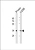 Western Blot at 1:8000 dilution Lane 1: mouse testis lysate Lane 2: U-2OS whole cell lysate Lysates/proteins at 20 ug per lane.