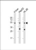 Western Blot at 1:2000 dilution Lane 1: human liver lysate Lane 2: HepG2 whole cell lysate Lane 3: HL-60 whole cell lysate Lysates/proteins at 20 ug per lane.