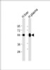 Western Blot at 1:2000 dilution Lane 1: human liver lysate Lane 2: human plasma lysate Lysates/proteins at 20 ug per lane.