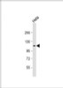 Western Blot at 1:2000 dilution + Hela whole cell lysate Lysates/proteins at 20 ug per lane.