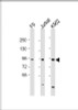 Western Blot at 1:2000 dilution Lane 1: F9 whole cell lysate Lane 2: Jurkat whole cell lysate Lane 3: K562 whole cell lysate Lysates/proteins at 20 ug per lane.