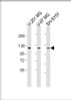 Western Blot at 1:2000 dilution Lane 1: U-251 MG whole cell lysate Lane 2: U-87 MG whole cell lysate Lane 3: SH-SY5Y whole cell lysate Lysates/proteins at 20 ug per lane.