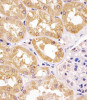 Antibody staining APIP in human kidney tissue sections by Immunohistochemistry (IHC-P - paraformaldehyde-fixed, paraffin-embedded sections) .