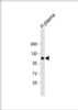 Western Blot at 1:2000 dilution + human plasma lysate Lysates/proteins at 20 ug per lane.