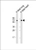 Western Blot at 1:2000 dilution Lane 1: human fetal lung lysate Lane 2: human fetal heart lysate Lysates/proteins at 20 ug per lane.