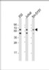 Western Blot at 1:2000 dilution Lane 1: 293 whole cell lysate Lane 2: Jurkat whole cell lysate Lane 3: SH-SY5Y whole cell lysate Lysates/proteins at 20 ug per lane.