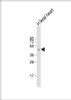 Western Blot at 1:1000 dilution + human fetal heart lysate Lysates/proteins at 20 ug per lane.