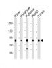 Western Blot at 1:2000 dilution Lane 1: human liver lysate Lane 2: human fetal liver lysate Lane 3: human plasma lysate Lane 4: HepG2 whole cell lysate Lane 5: human brain lysate Lysates/proteins at 20 ug per lane.