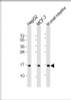 Western Blot at 1:2000 dilution Lane 1: HepG2 whole cell lysate Lane 2: MCF-7 whole cell lysate Lane 3: mouse small intestine lysate Lysates/proteins at 20 ug per lane.