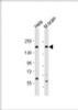 Western Blot at 1:2000 dilution Lane 1: Hela whole cell lysate Lane 2: mouse brain lysate Lysates/proteins at 20 ug per lane.