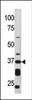 Western blot analysis of anti-ART1 Pab in HepG2 cell line lysate (35ug/lane)