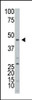 Western blot analysis of ART3 Antibody in HL60 cell line lysates (25ug/lane) .