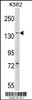 Western blot analysis of hAGL-C371 in K562 cell line lysates (35ug/lane)