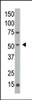 Western blot analysis of anti-hMGAT1-R426 Pab in Y79 cell line lysate.